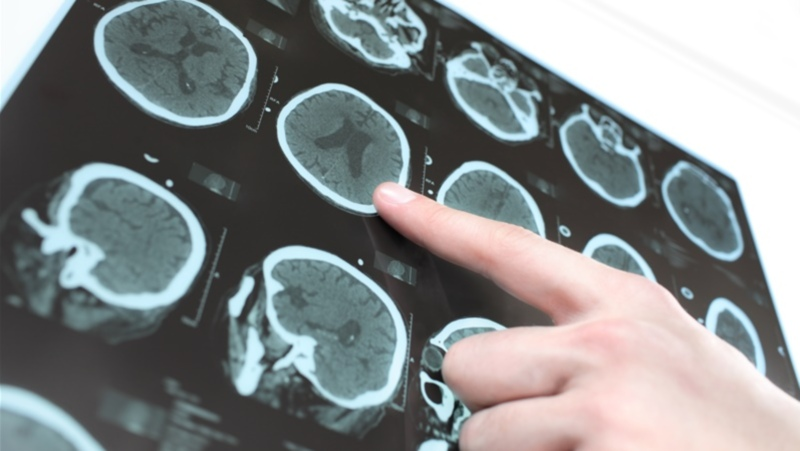 Brain scan