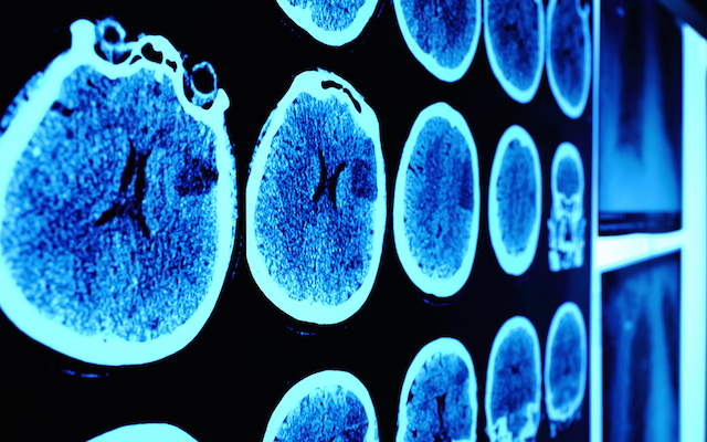 Skull CT scan picture on the wall