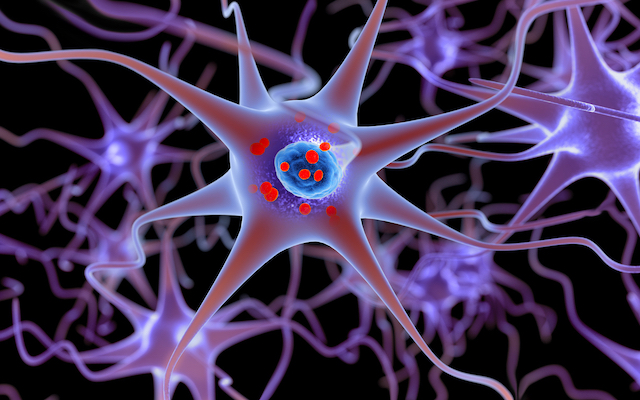 alpha-synuclein Parkinson's MJFF competition
