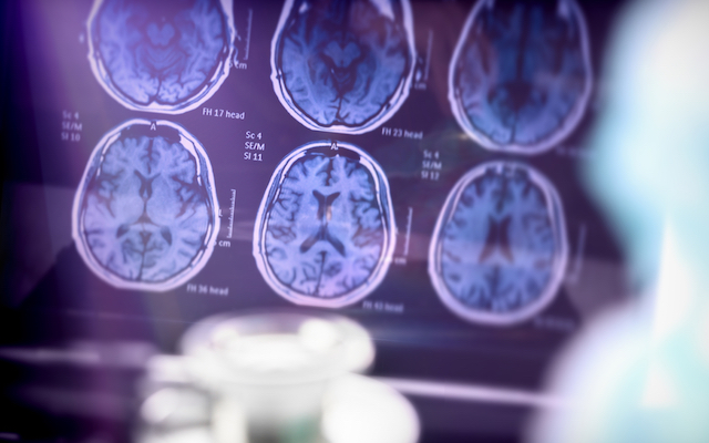 Brain scans