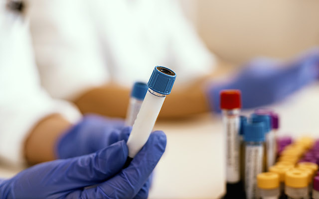 A closeup of test tubes being examined by scientists.