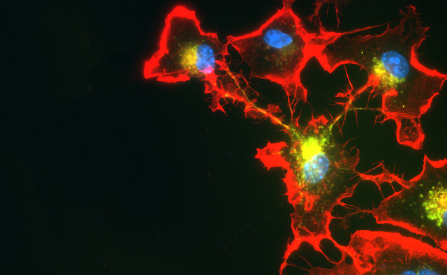 An abstract red, blue and yellow cell cluster.