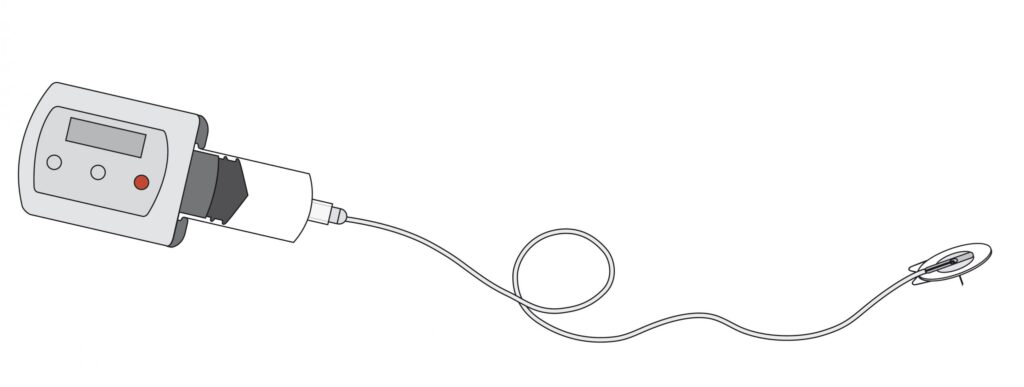 An image of a apomorphine infusion set and pump