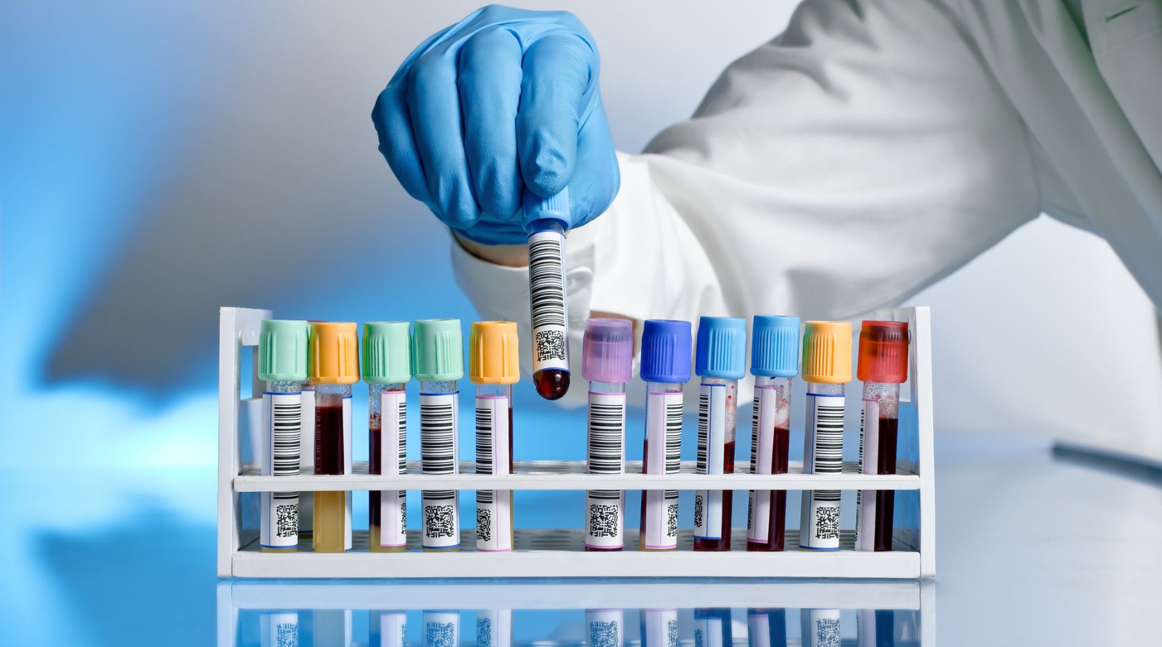 A row of blood sample tubes to signify a blood test for Parkinson's