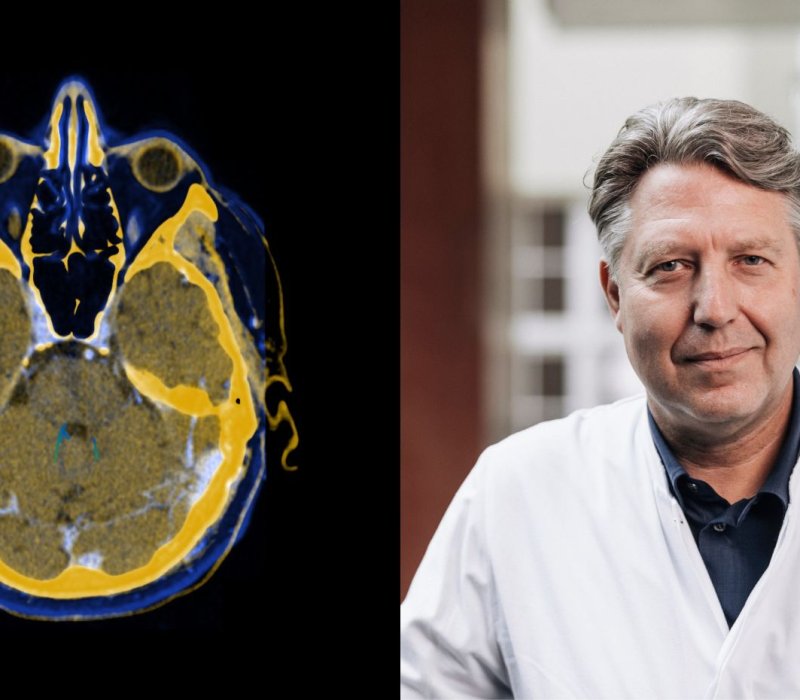 New DBS technology could deliver more personalised Parkinson’s care