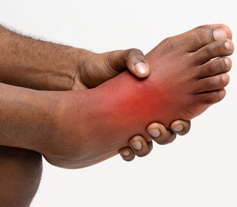 Dystonia (involuntary muscle spasms) in Parkinson's