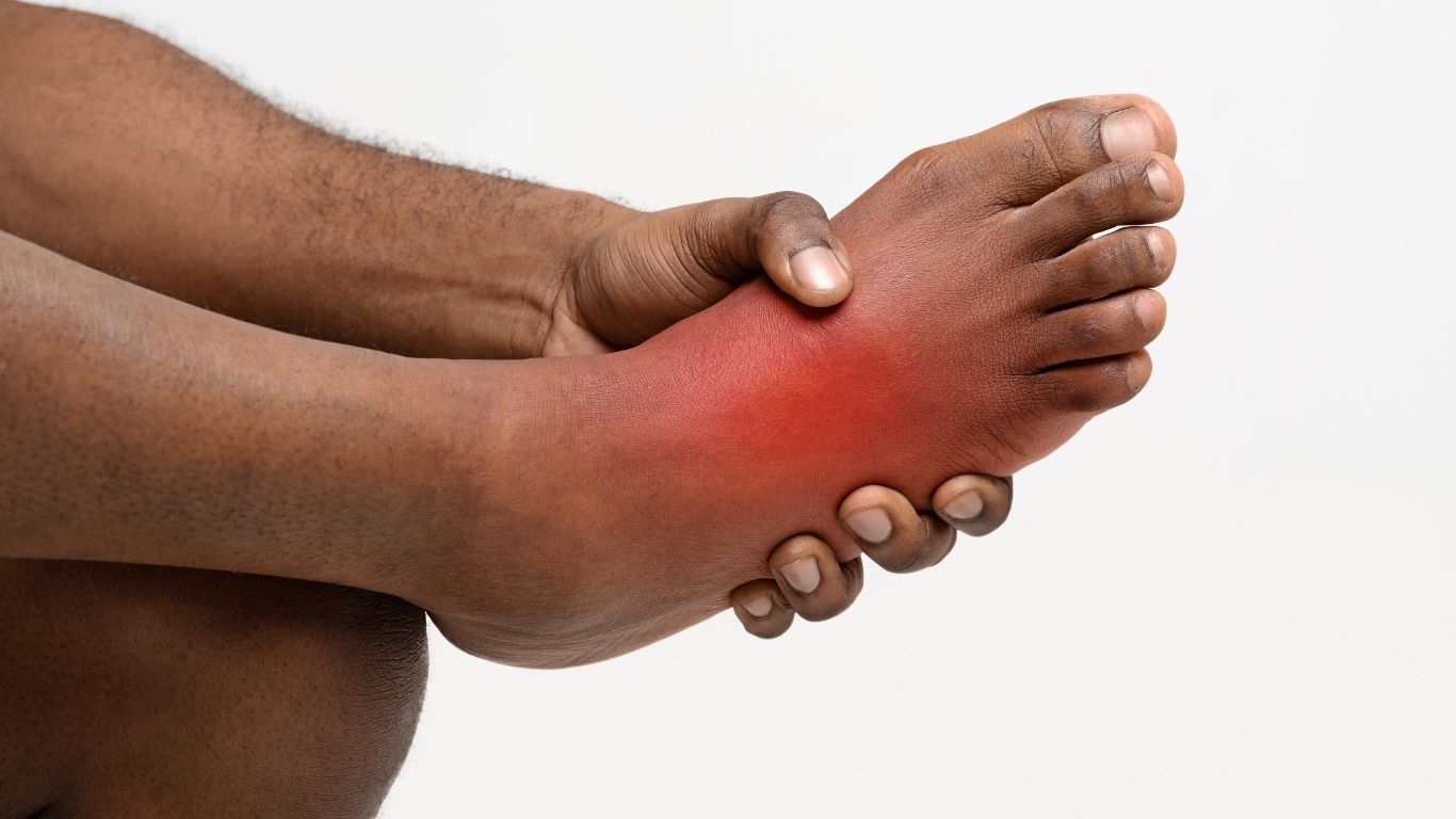 Dystonia (involuntary muscle spasms) in Parkinson's