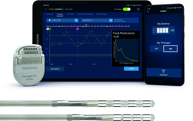 The Percept™ PC neurostimulator device.