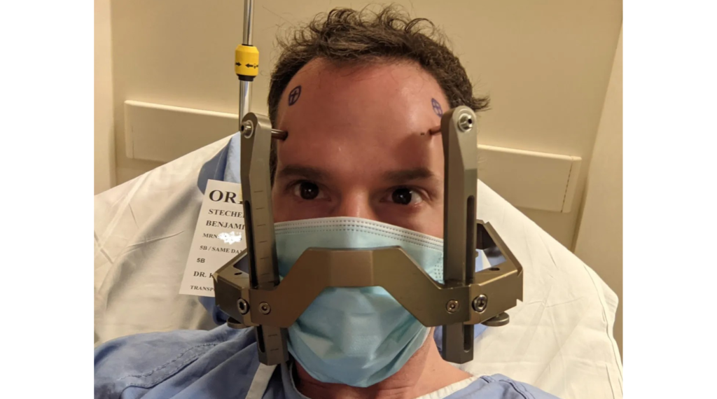 Ben Stecher after receiving DBS surgery